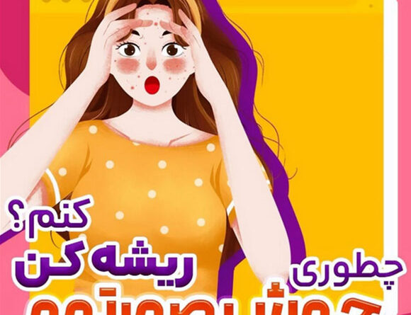 چطوری جوش صورتمو ریشه کن کنم؟