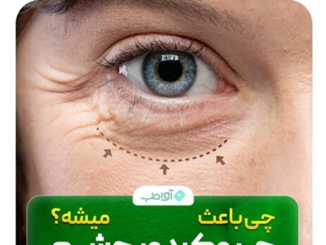 چه چیزهایی باعث چروک دور چشم می شوند؟