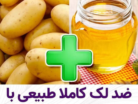 ضدلک کاملا طبیعی با سیب زمینی و عسل