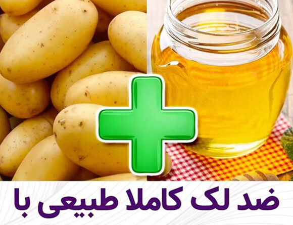 ضدلک کاملا طبیعی با سیب زمینی و عسل