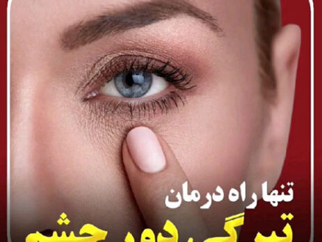 تنها راه درمان تیرگی دور چشم