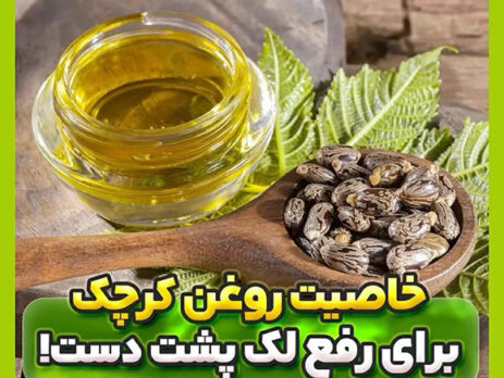 خاصیت روغن کرچک برای لک پشت دست