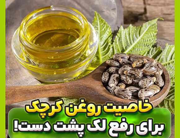 خاصیت روغن کرچک برای لک پشت دست