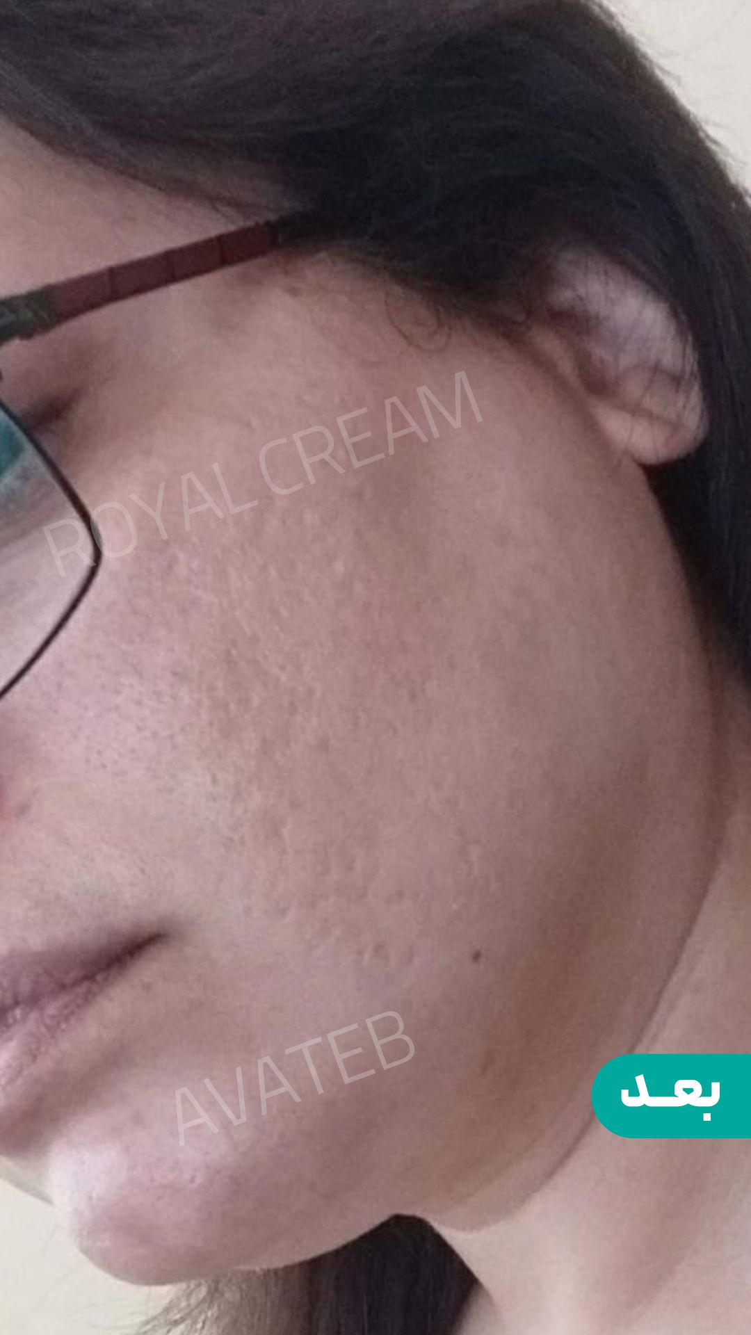 رضایت از کرم ژل رویال