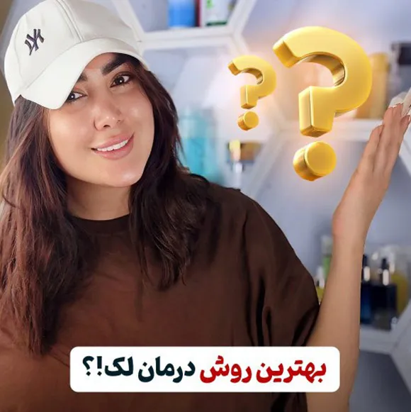 بهترین روش درمان لک صورت