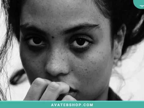 رژیم غذایی و تاثیر آن روی لک صورت