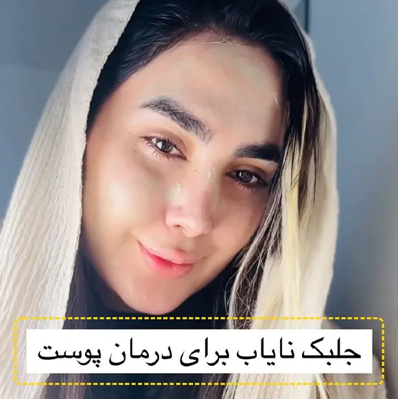 کرم جلبک اسپیرولینا